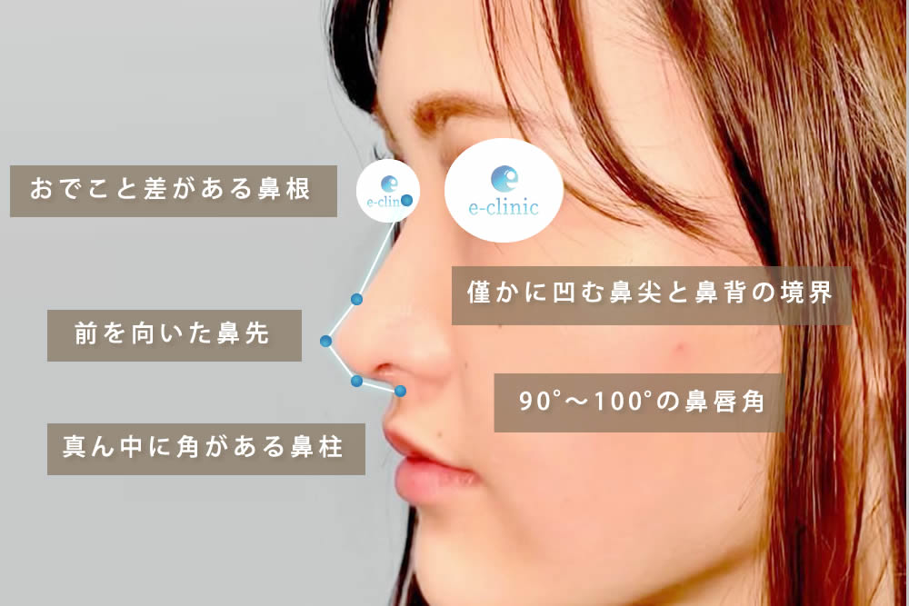 鼻整形の５つのポイントの図解