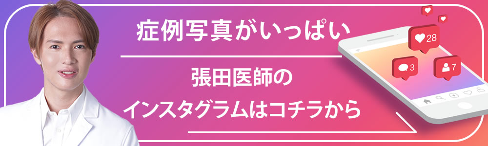 インスタグラムの誘導バナー