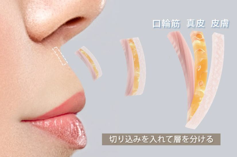 口元の皮膚の断面図